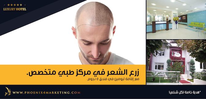 شركة فينكس تطلق منتج زراعة الشعر